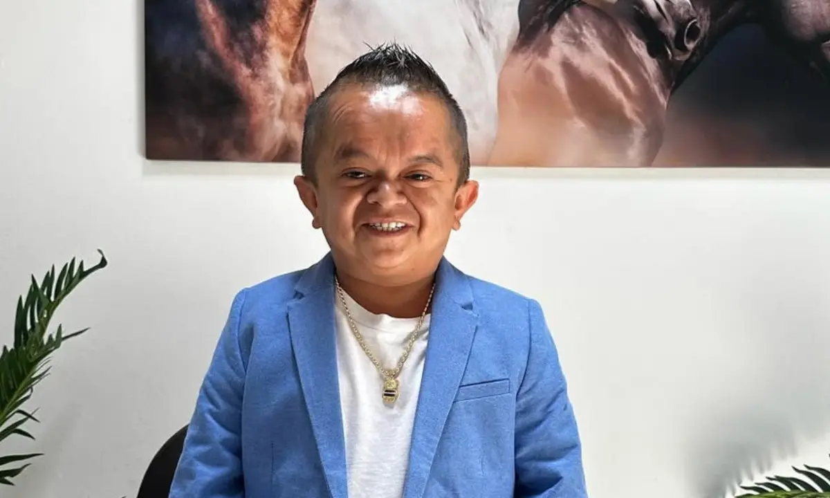 ¡Jorgito Guayaco sorprende con un cambio radical en su sonrisa!- Últimas noticias Ecuador